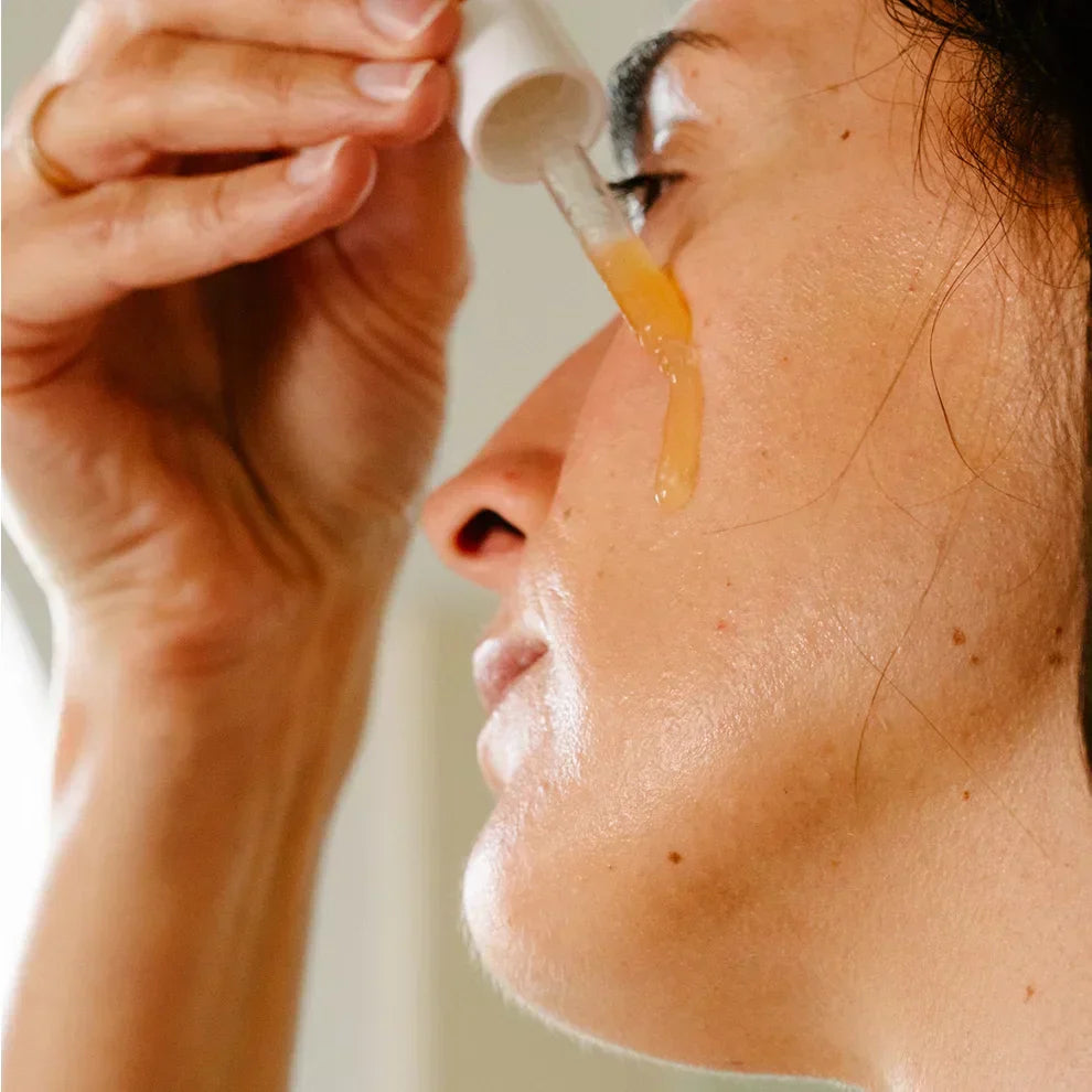 Comment prévenir l'acné après l'été : 5 gestes essentiels pour une peau nette
