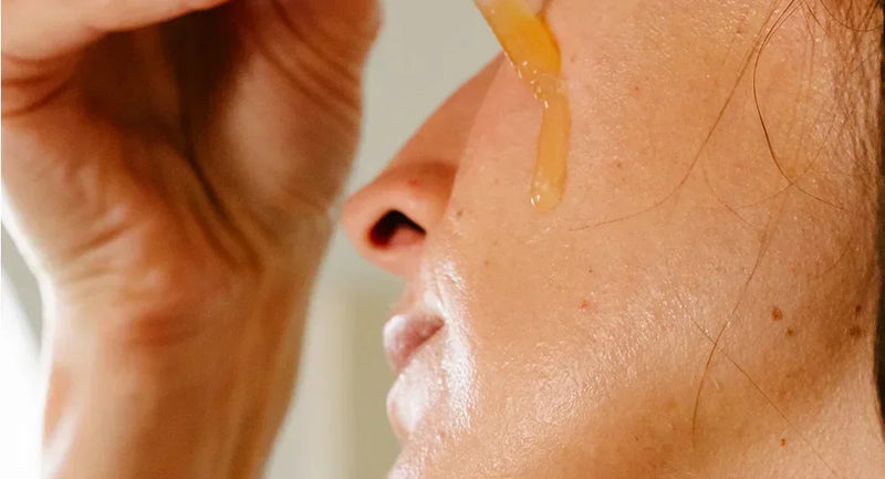 Comment prévenir l'acné après l'été : 5 gestes essentiels pour une peau nette