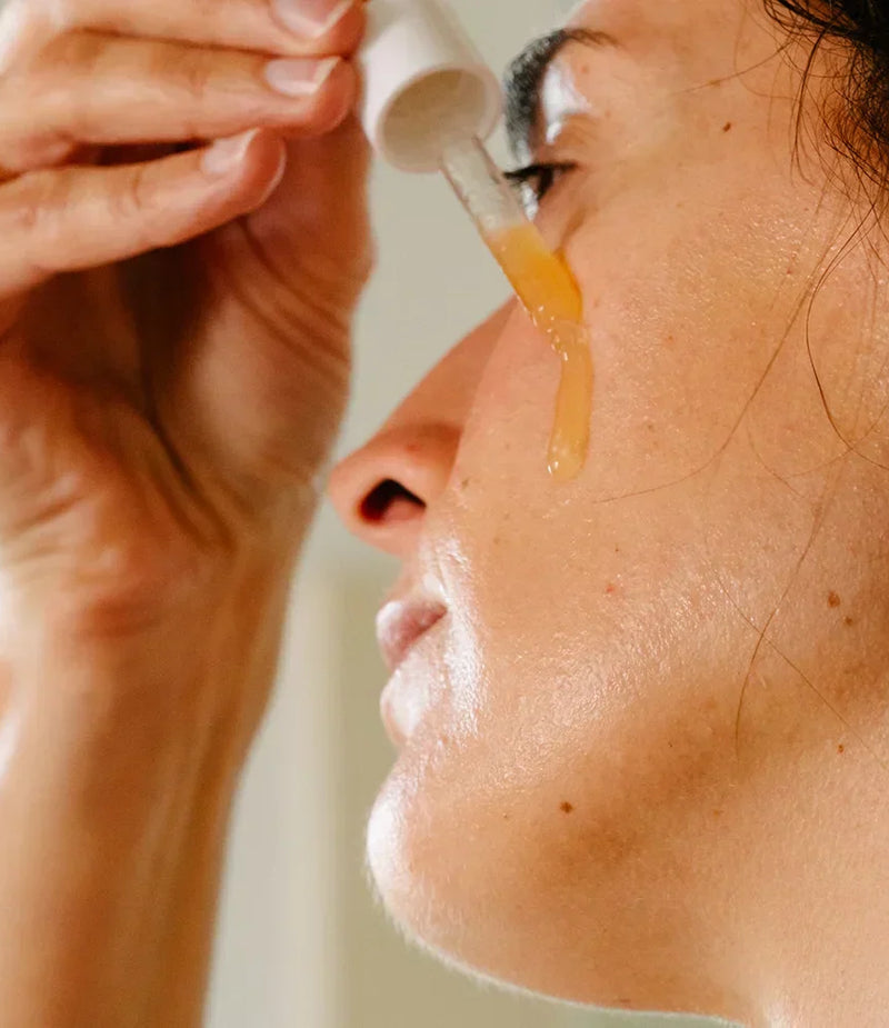 Comment prévenir l'acné après l'été : 5 gestes essentiels pour une peau nette